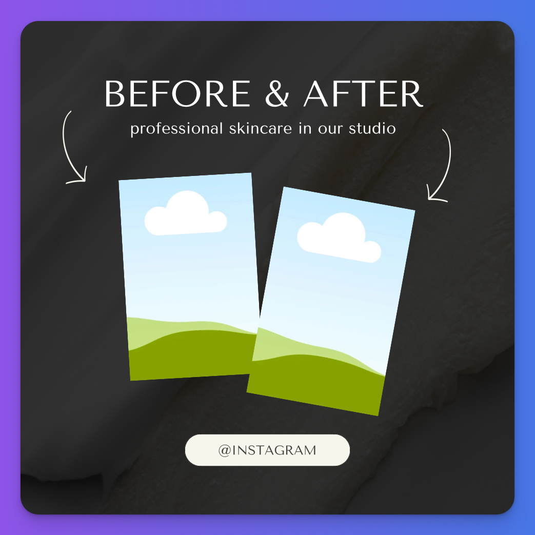 Before and After Template preview